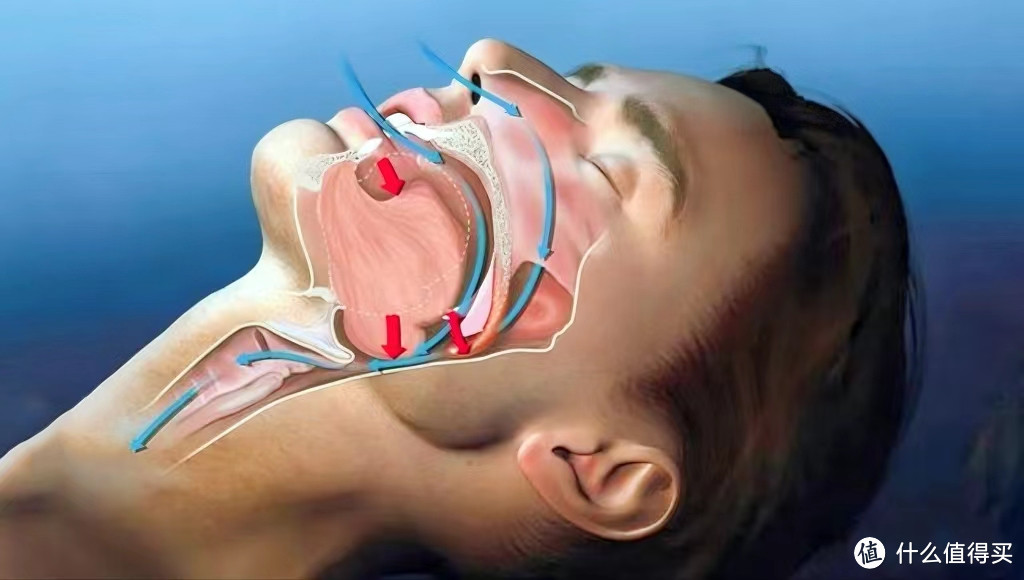 身体会报警，别不拿打鼾当回事儿！选择呼吸机究竟是不是智商税，“枕边人”亲测告诉你！