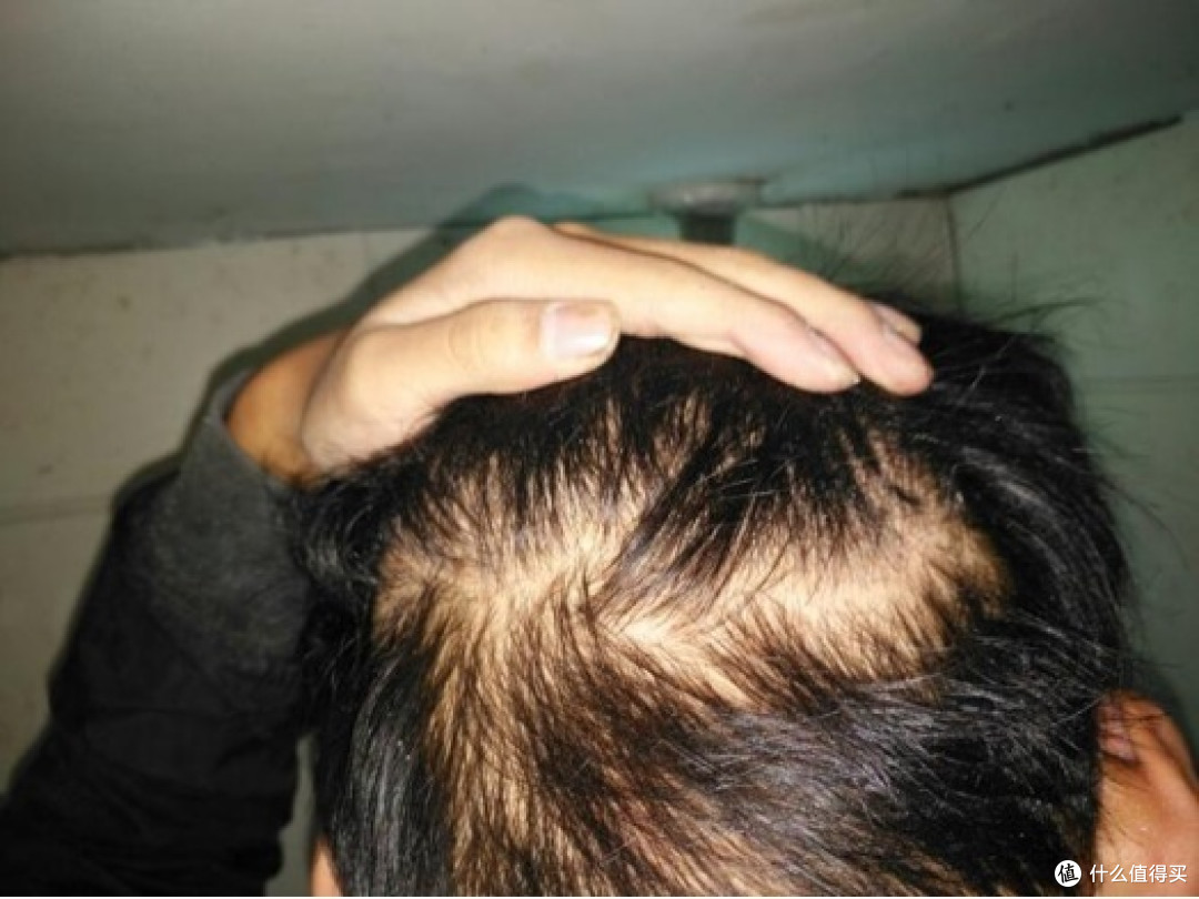 头发少怎么增加发量?12大养护危害禁忌要警惕_洗发产品_什么值得买
