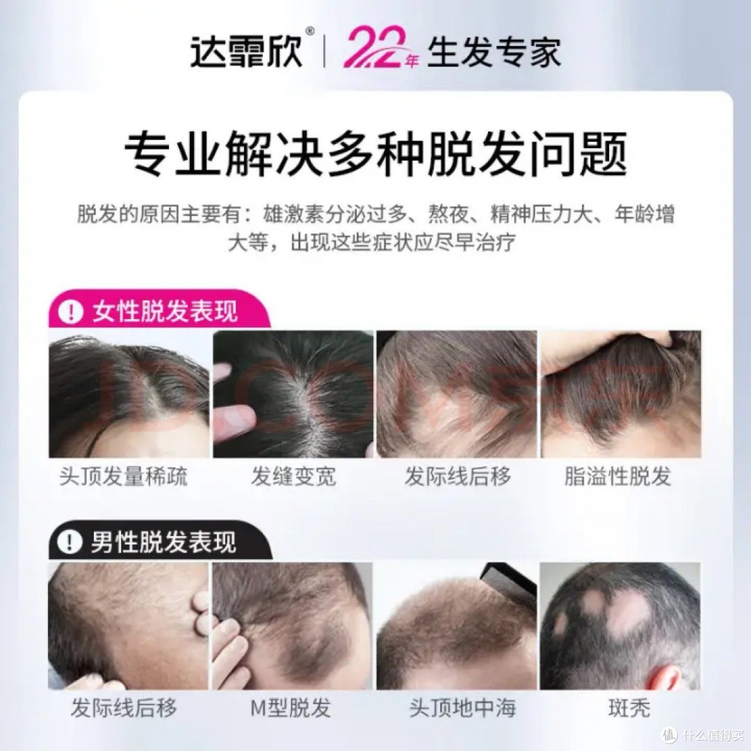 如何预防脱发