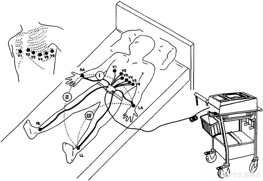 小心脏怎么来守护？乐普心电监护仪ER1和2有什么不同？