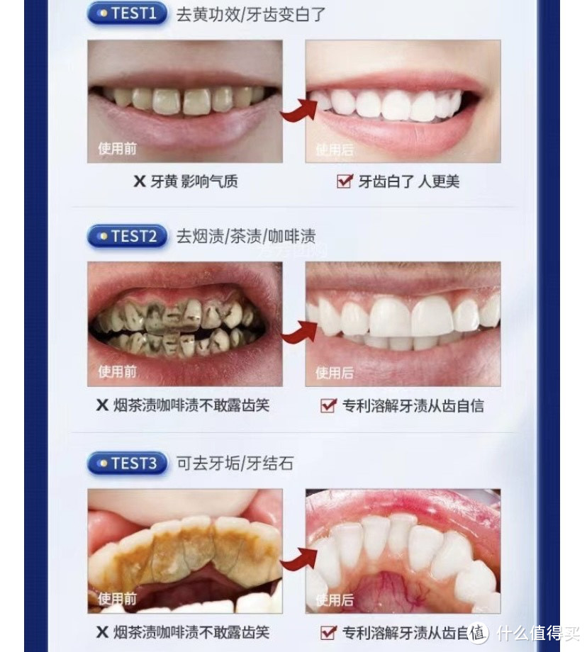 牙结石溶解喷雾