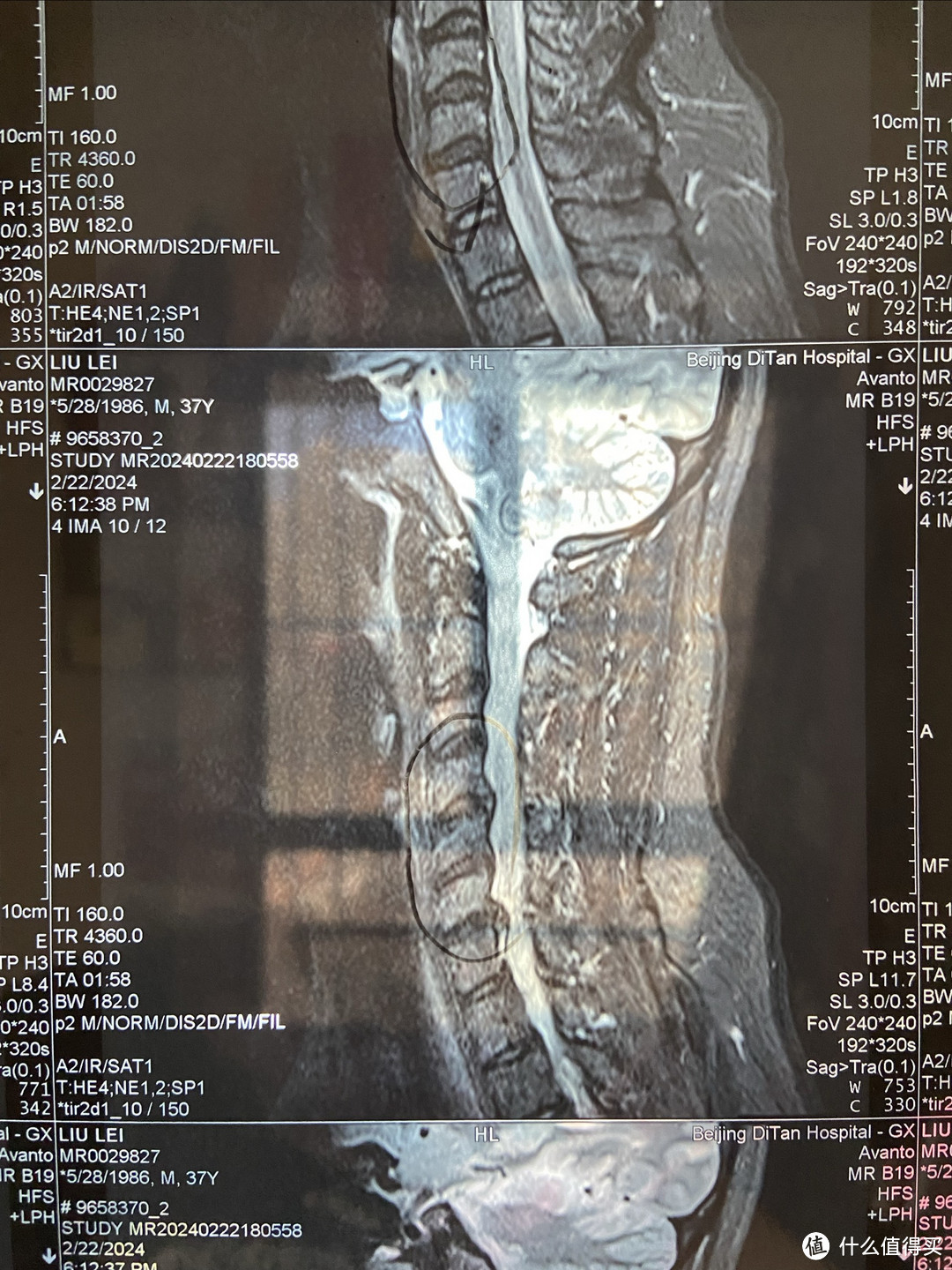 铅笔图画处已经直了，且有突出