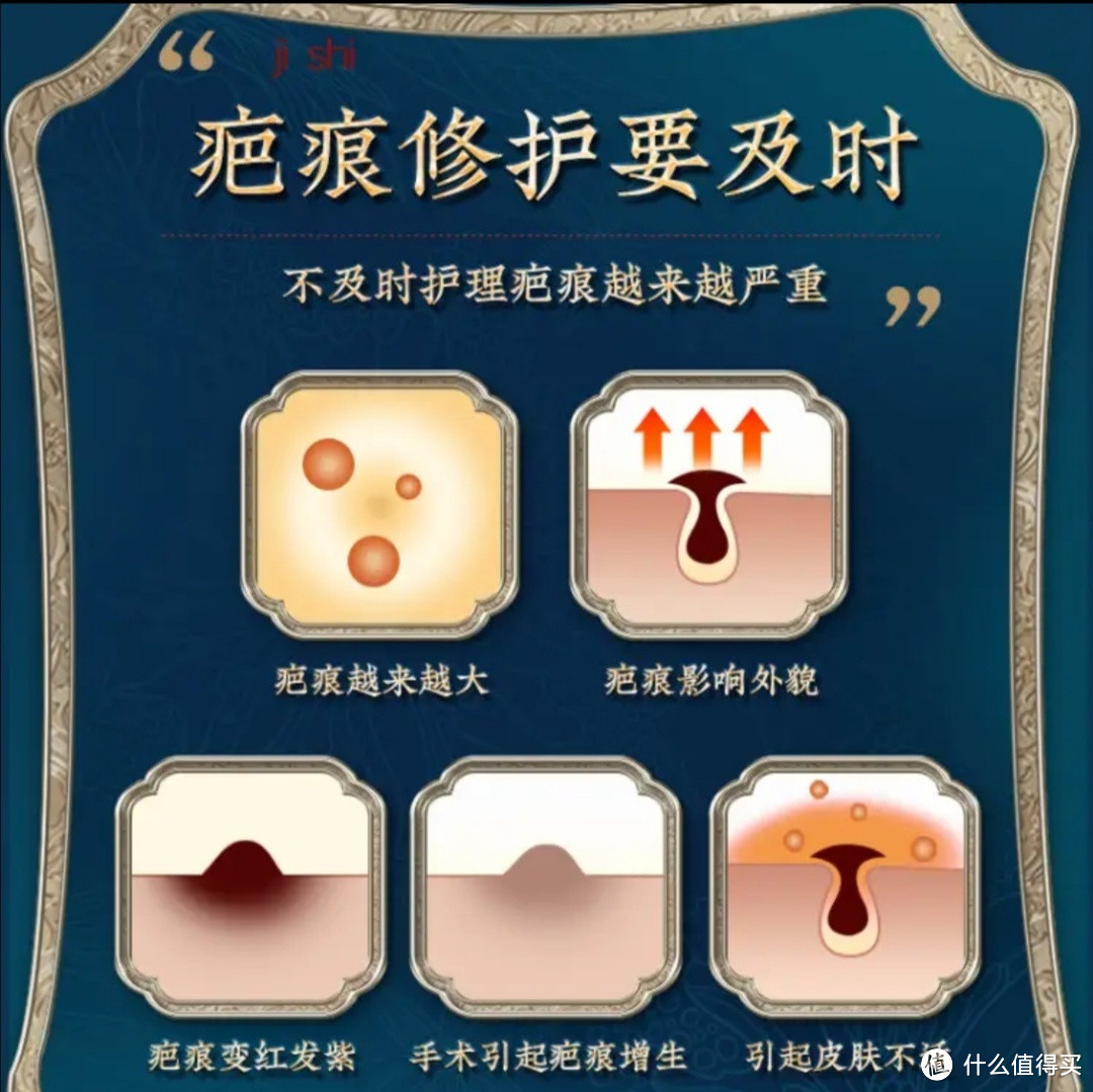 北京同仁堂去疤膏,疤痕修复专家!
