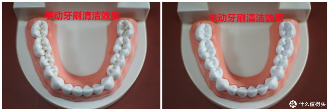 电动牙刷到底好不好？解读声波/旋转/扫振式优缺点