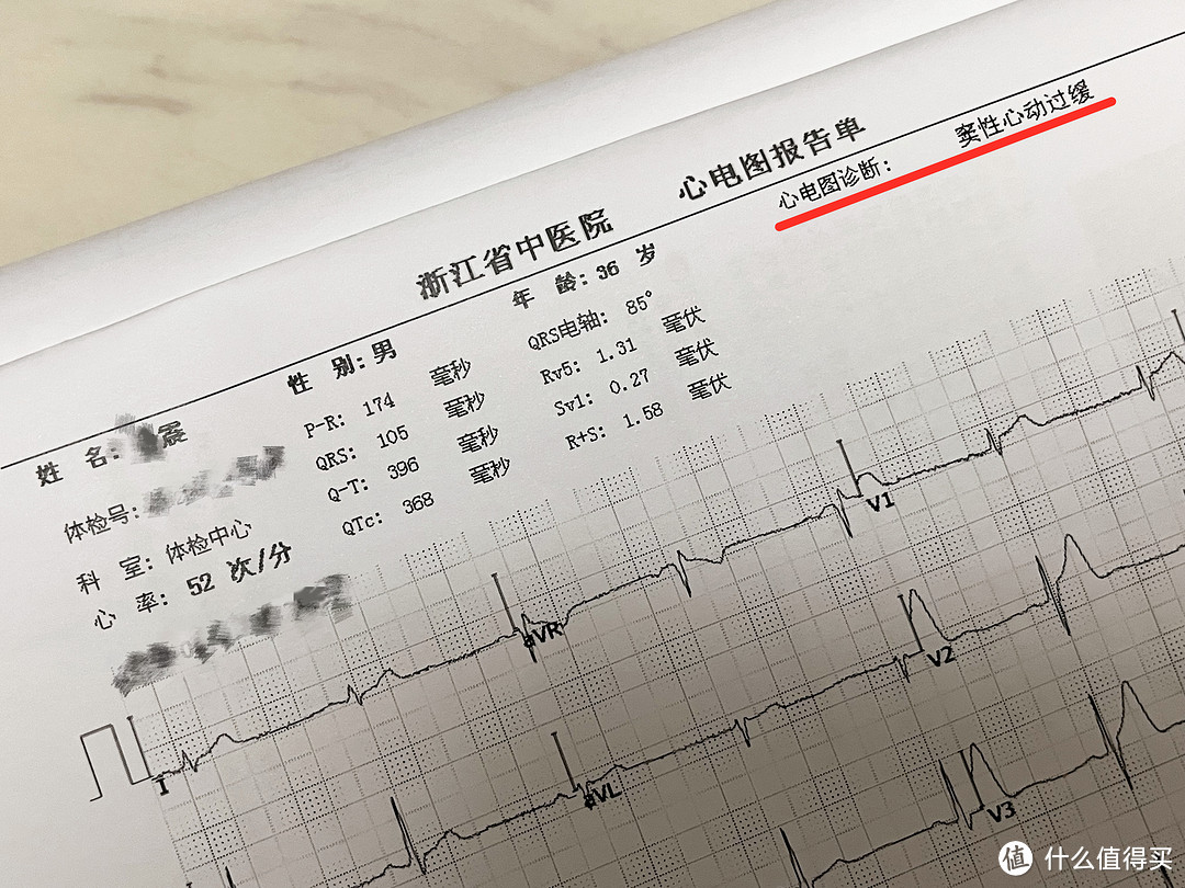 中年体检出窦性心动过缓后，及时为自己添了一份保障——乐普 LEPU 心安宝使用心得分享