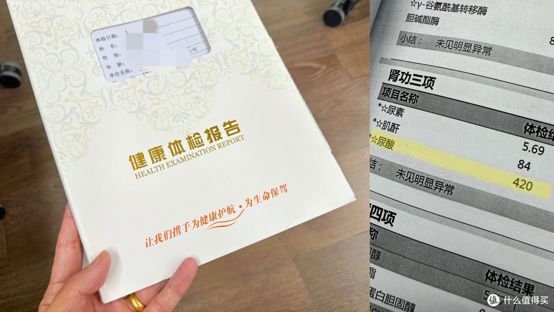 尿酸血糖精准测量，健康管理的得力助手-鱼跃 GU200血糖尿酸一体机