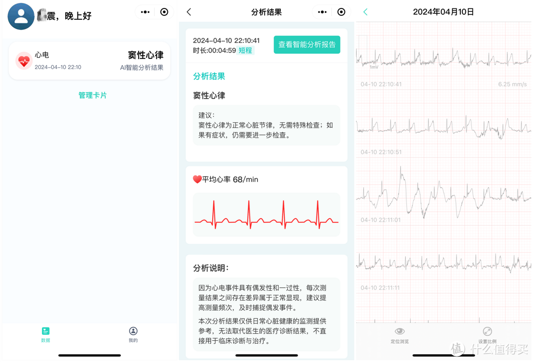 中年体检出窦性心动过缓后，及时为自己添了一份保障——乐普 LEPU 心安宝使用心得分享