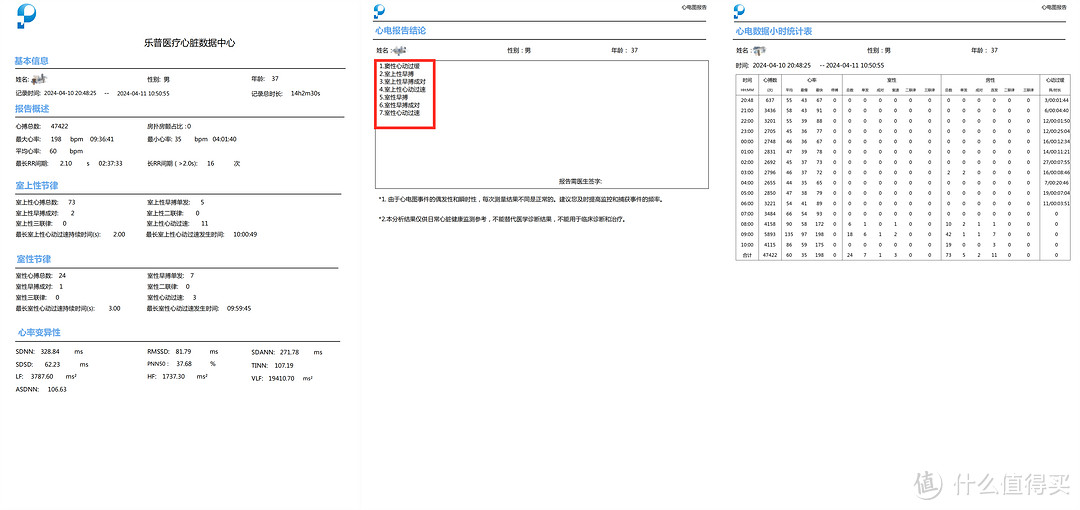 中年体检出窦性心动过缓后，及时为自己添了一份保障——乐普 LEPU 心安宝使用心得分享