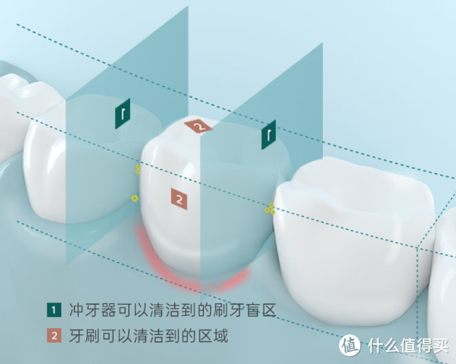 冲牙器会导致牙齿松动吗？警告四大缺点套路！