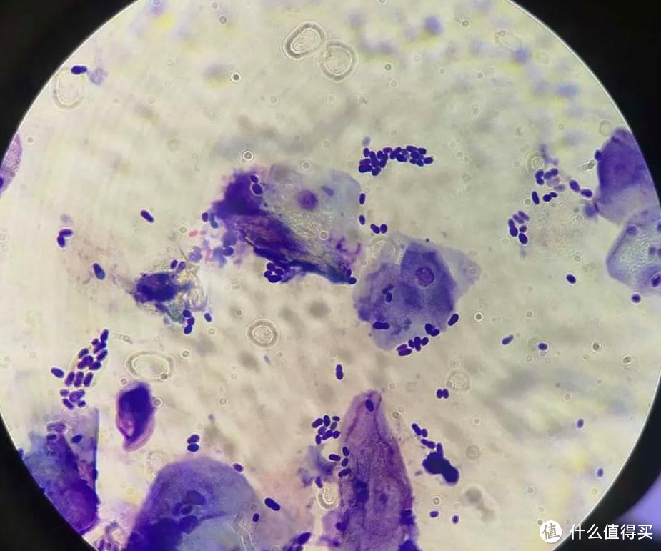 显微镜下的马拉色菌