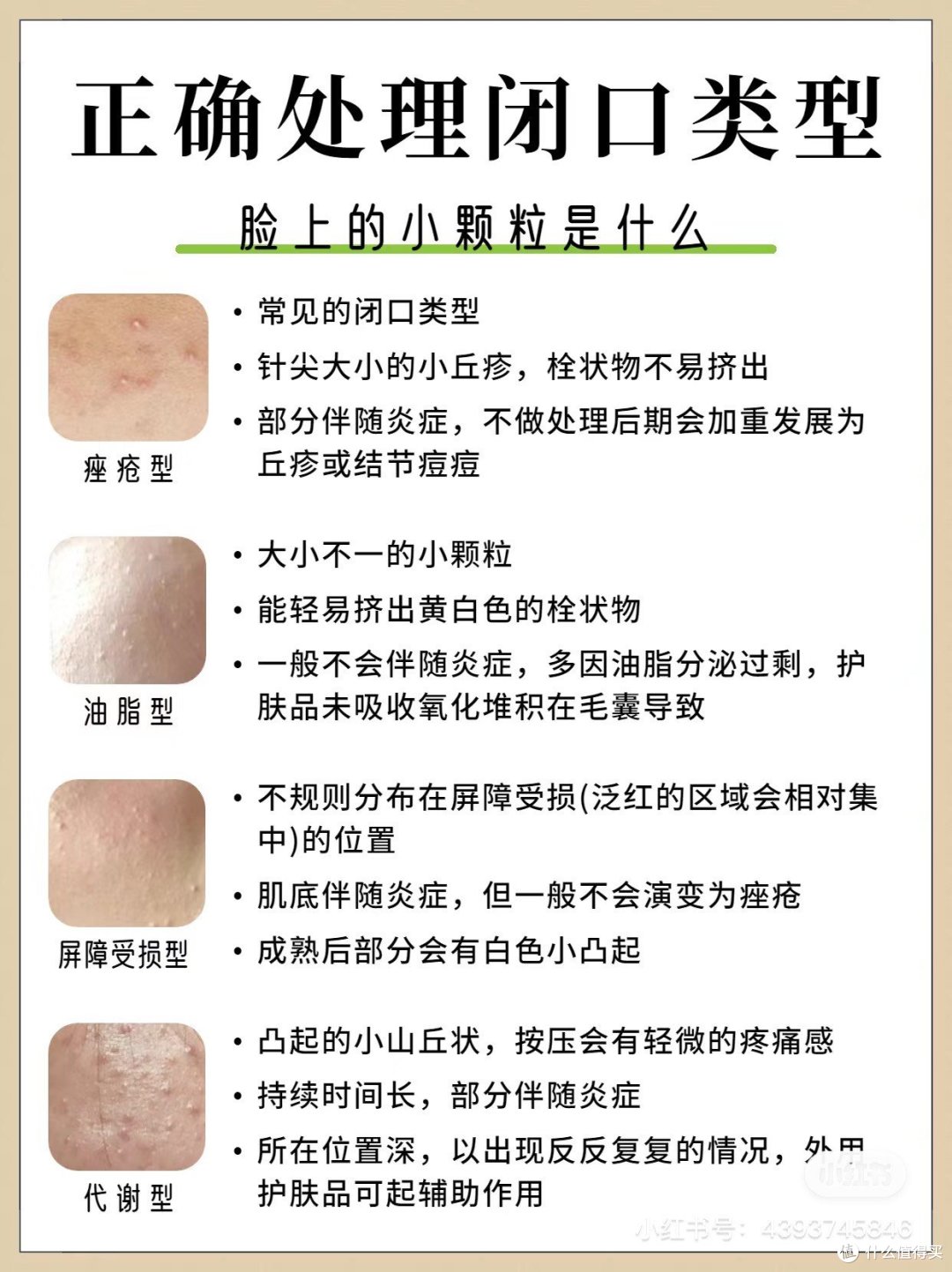 怎么分辨闭口和粉刺