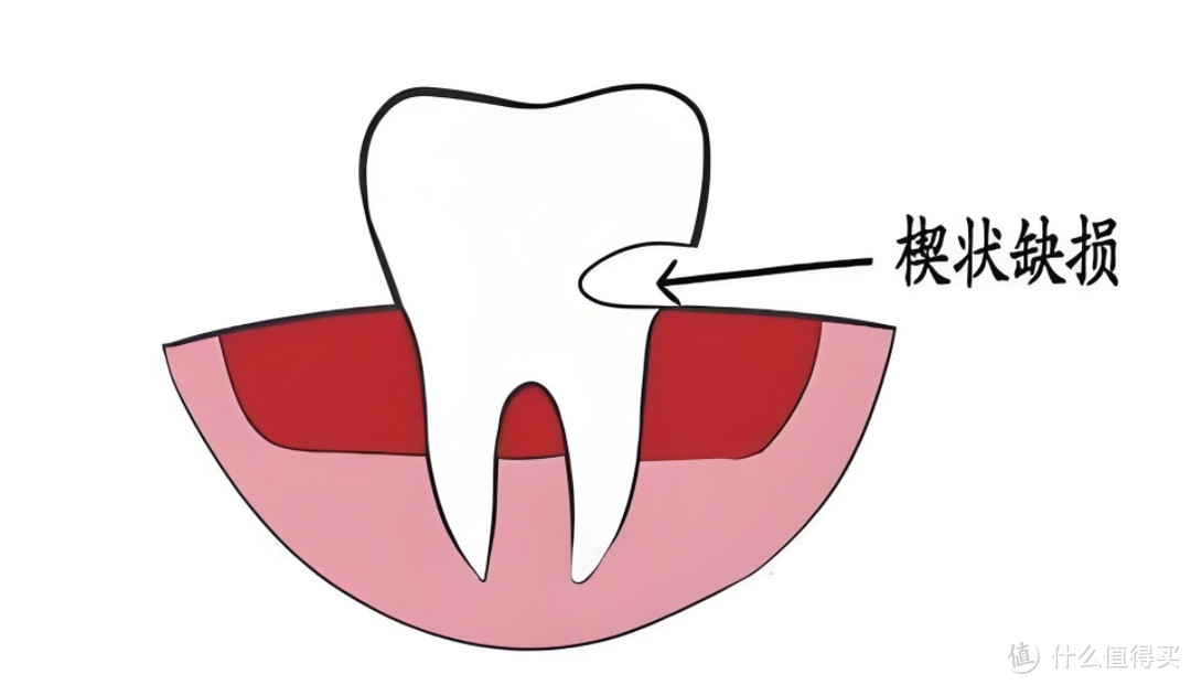 好好刷牙能省多少钱？这笔经济账你算过吗