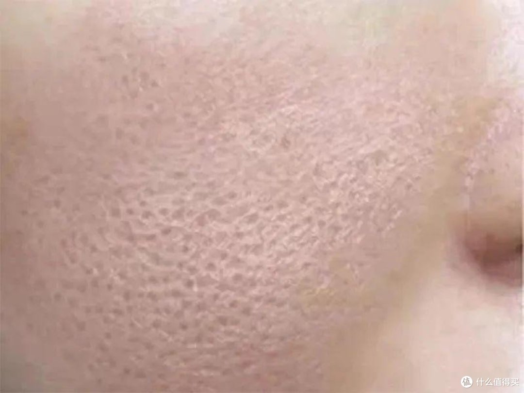 毛孔粗大产生的原因