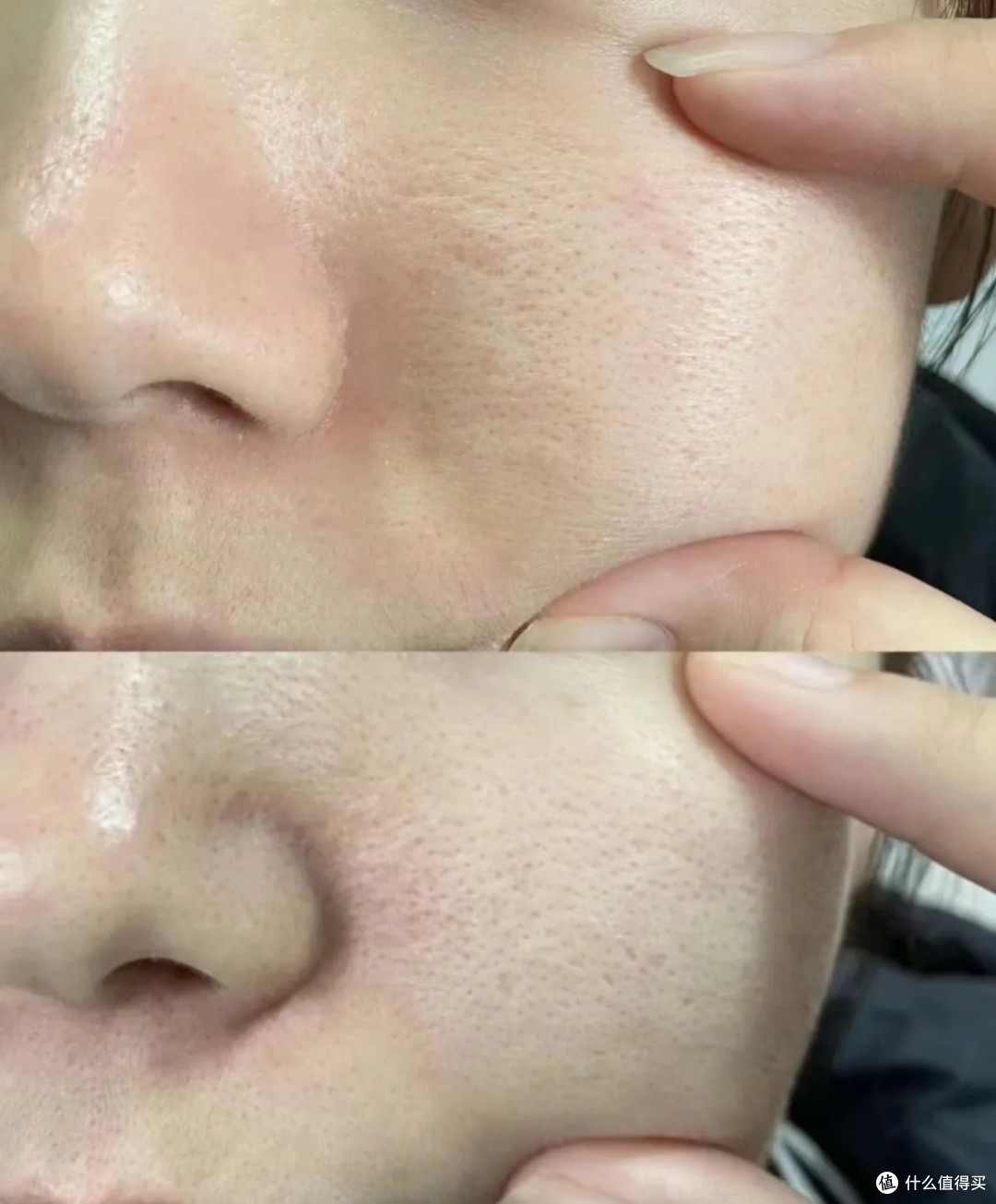 让我们告别油腻肌肤