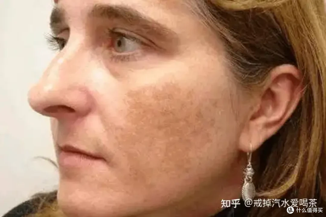立夏之后养肝才是绝佳时间!肝净了,脸也净了!熬夜党快收藏!