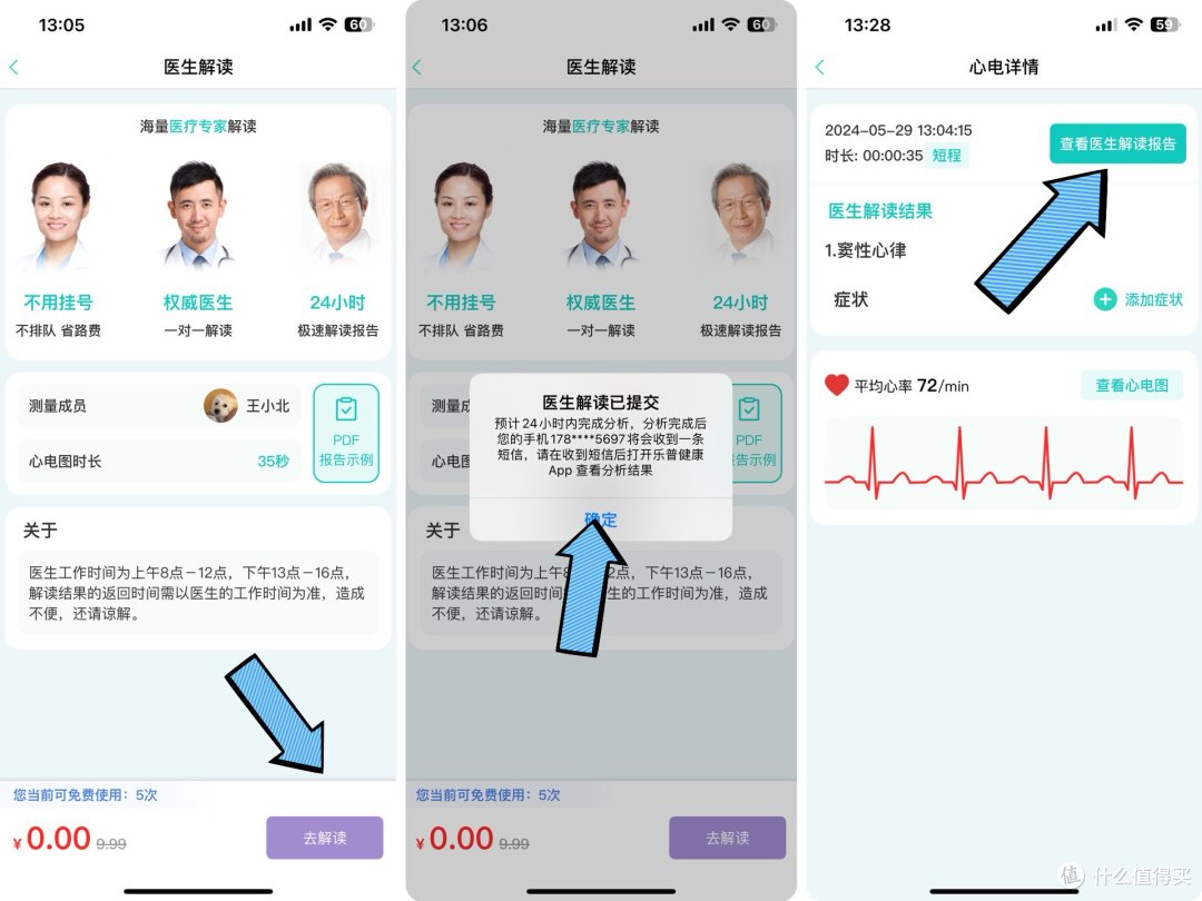 轻松自测!乐普ER2-S,打工人的心脏健康护卫