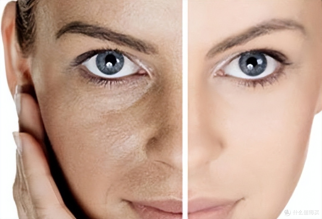 最好的除皱方法？15大科学去皱法避开烂脸风险陷阱