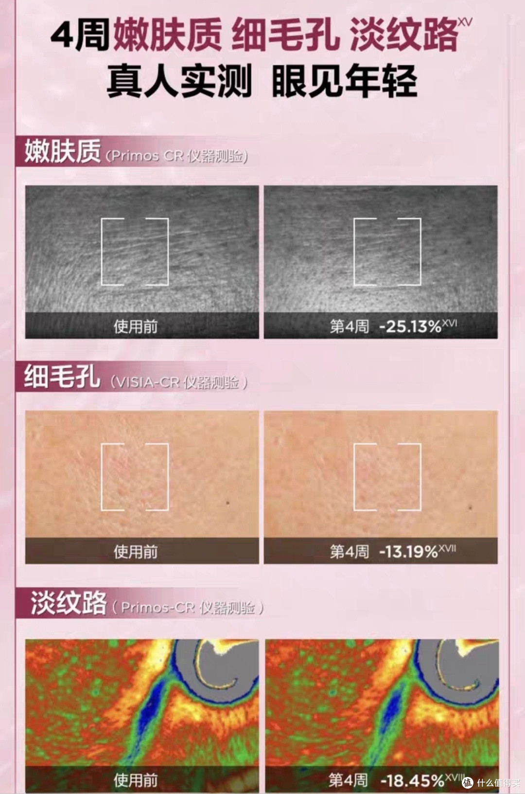 “伊丽莎白雅顿粉胶”,拯救你的敏感肌!