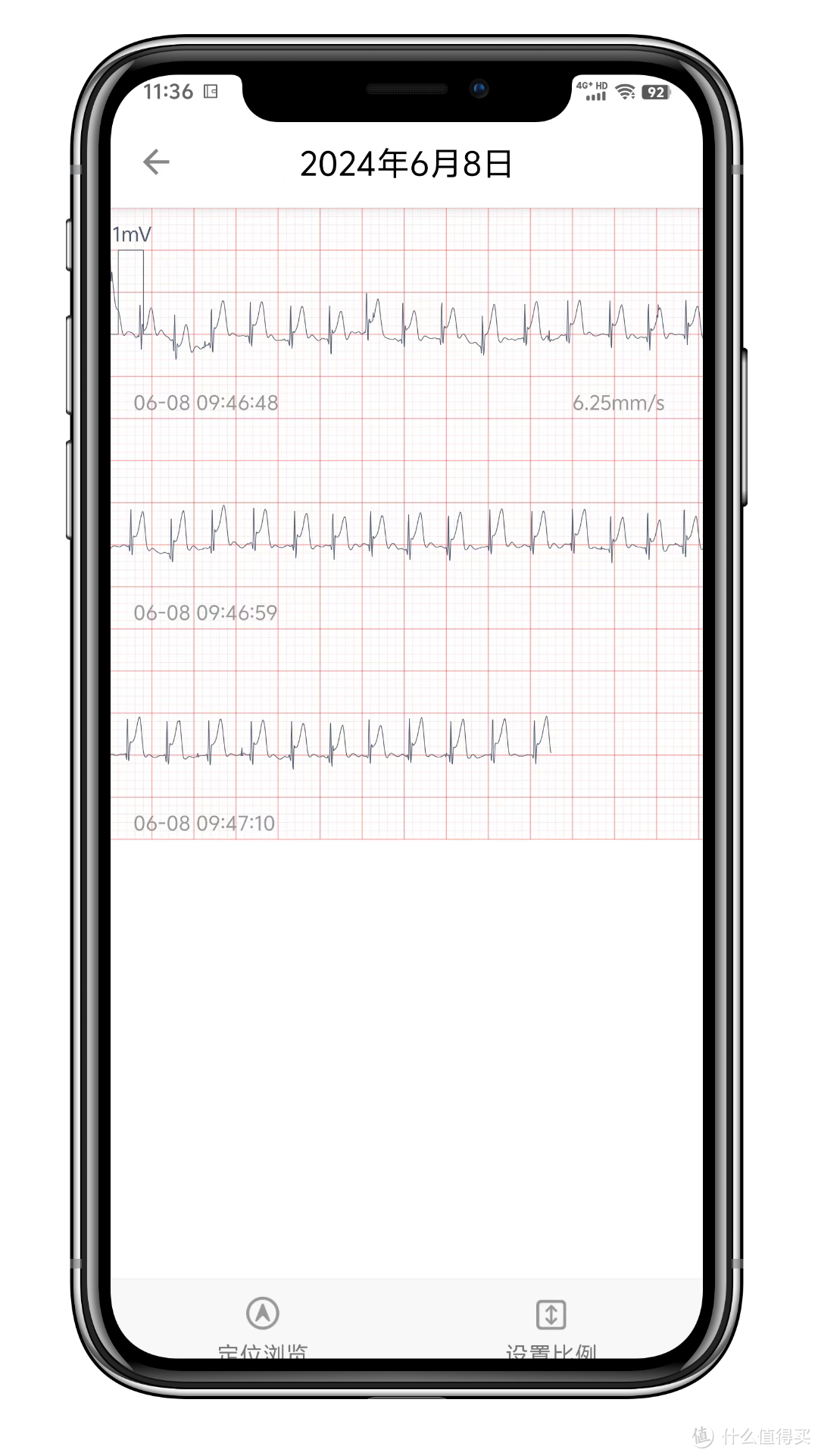 心电监测竟如此简单？乐普ER2-S，轻松守护心脏健康