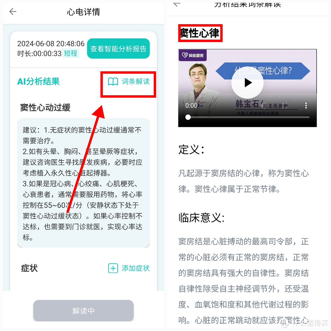 用它检测到自己 窦性心动过缓，为自己和家人添加一份保障，乐普ER2-S心率检测仪，值得拥有。