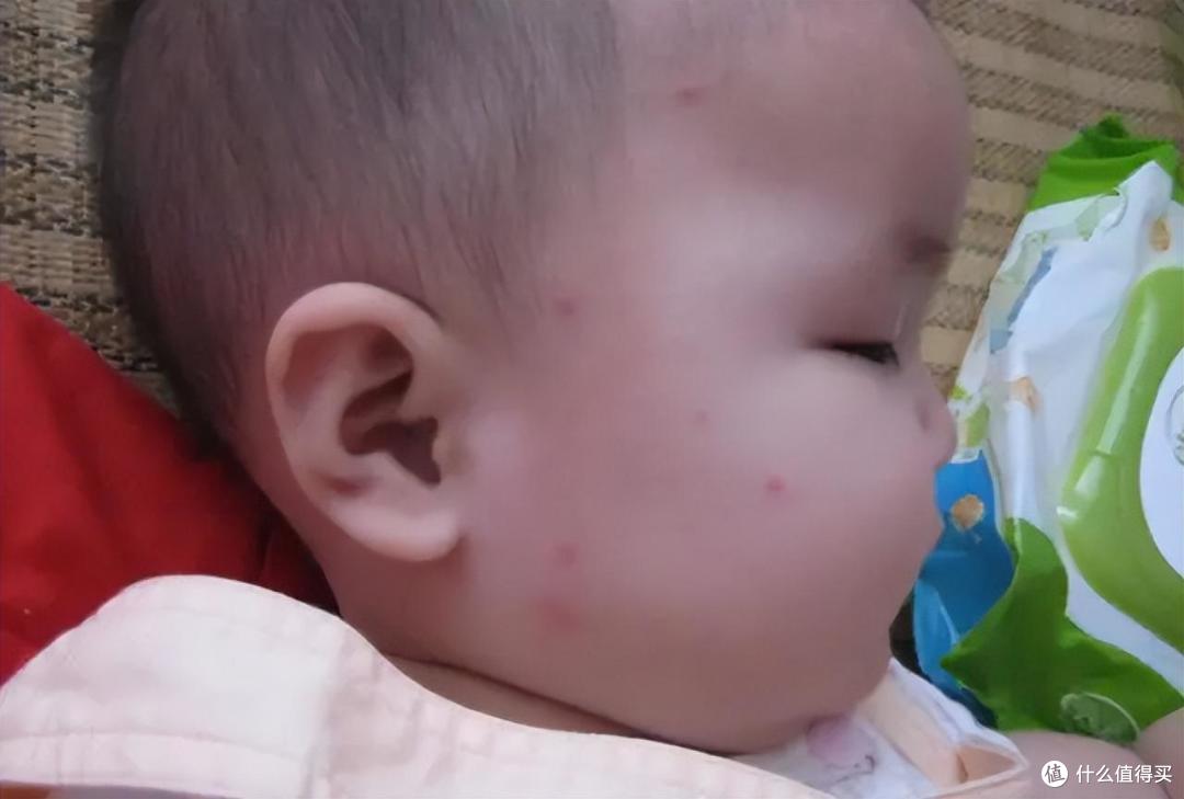 不想被“天敌”蚊子叮咬，牢记这三种灭蚊方法，都是生活经验！