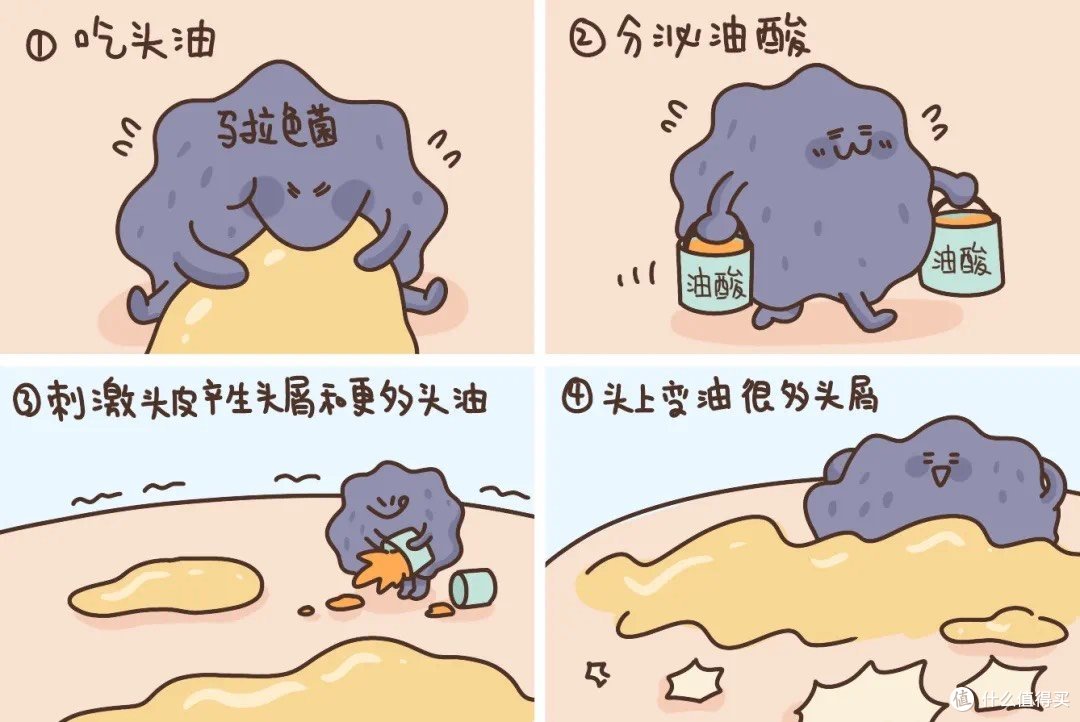 希尔生二硫化硒洗剂,和随风飘落的头屑say goodbye!