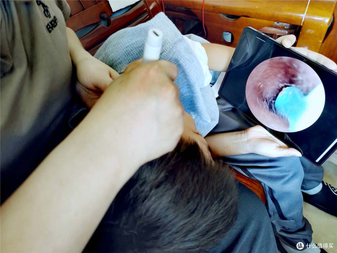 耳深可见，视之即清——西圣可视化智能耳勺的革新与益处！