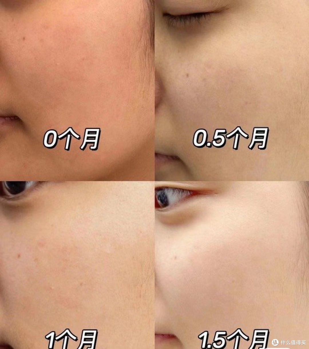 虾青素面膜去黄