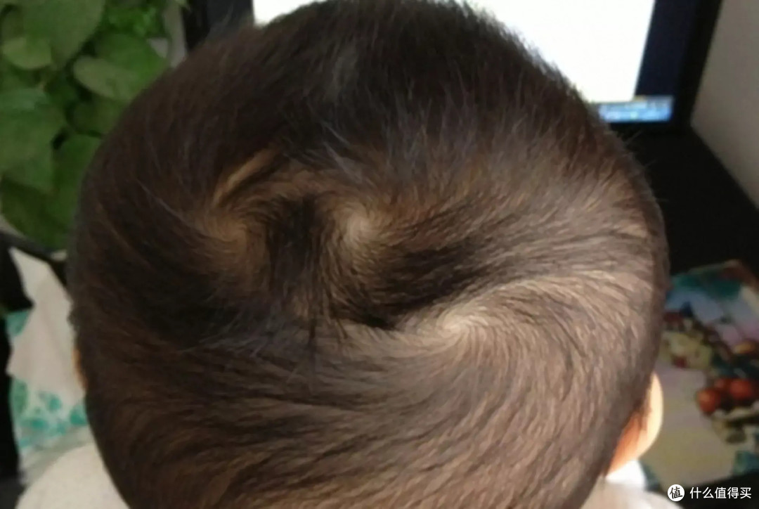 “我儿头顶两个旋,犟得像头牛”,孩子多个发旋意味着啥?科学解释来了