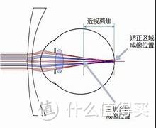 眼镜小知识