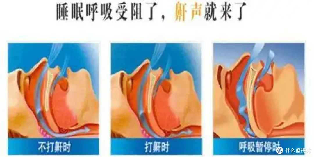 可能导致身体病变！如何科学无创止鼾？