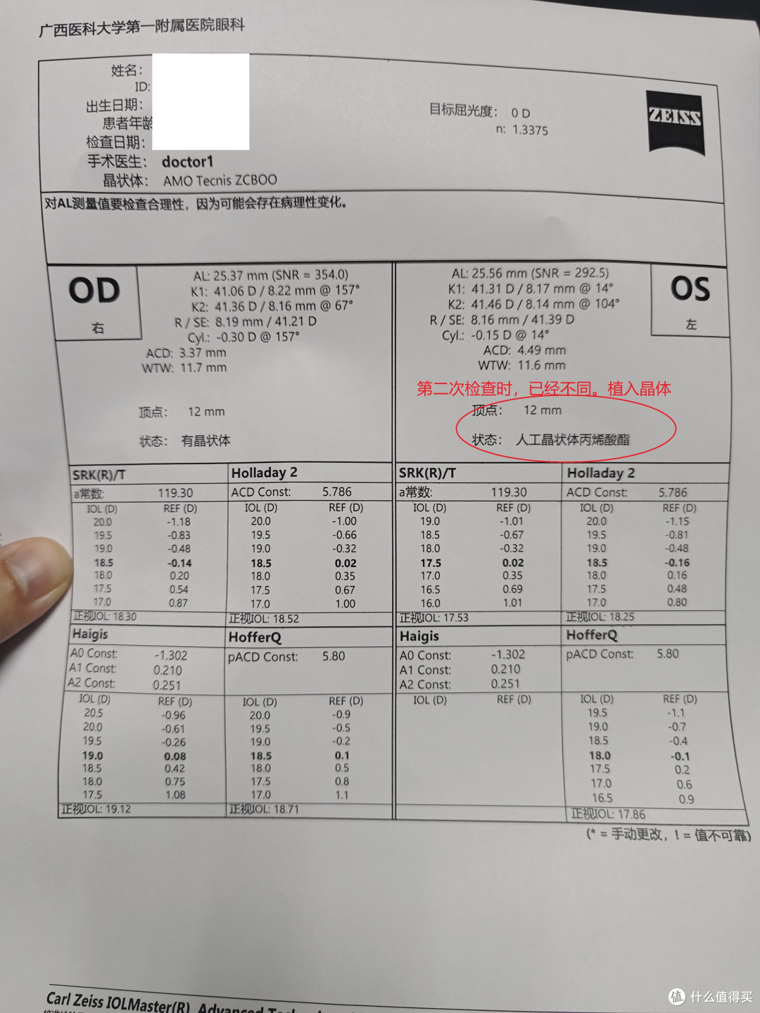 医院的WIFI网速真好!38岁的我,双眼做了白内障手术