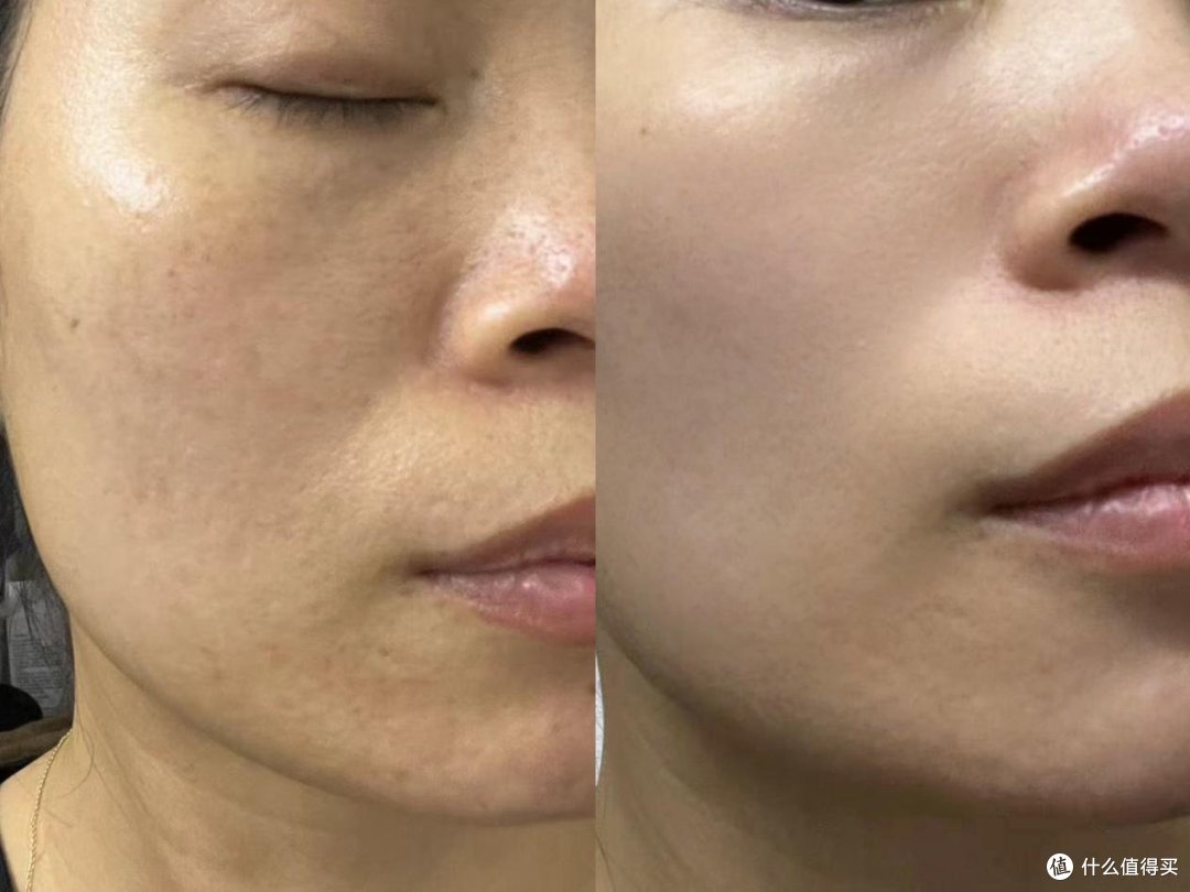 精华液哪个牌子最好用？五大热销产品实测大揭秘