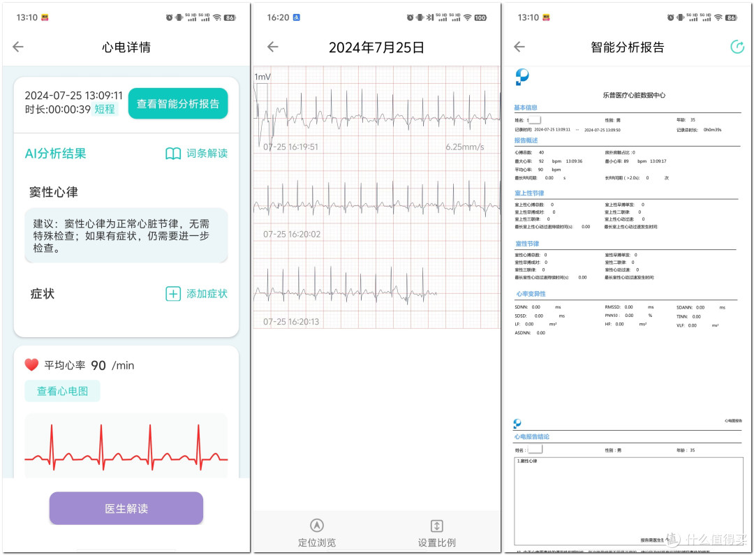 精选智能心电仪,守护家人的心脏健康——专业级家用心电仪选购攻略
