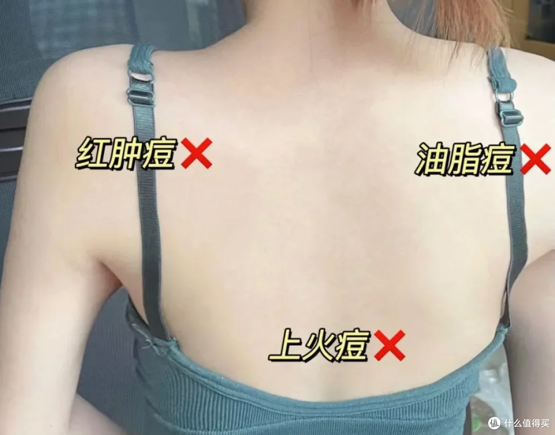 今天才知道,2元的硫磺皂,竟然妙用无穷,看完涨知识了