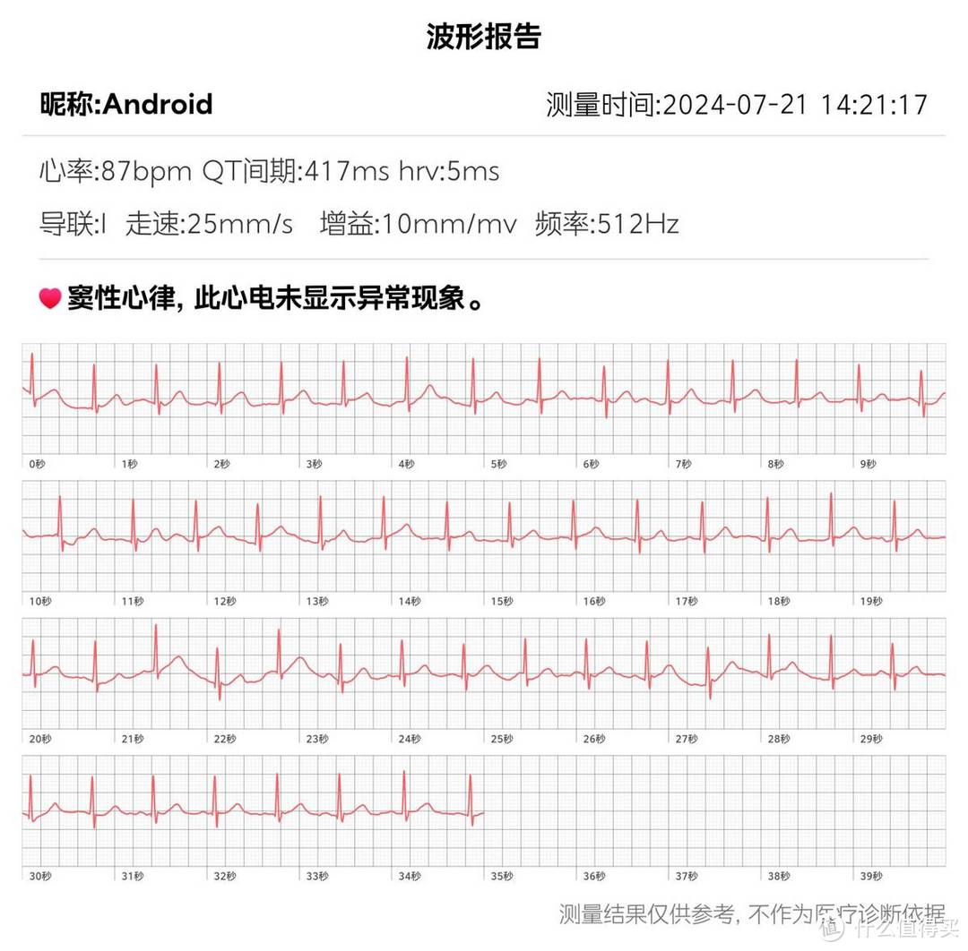 智能手表适合送给父母吗？dido E56S智能手表怎样?附实测体验分享