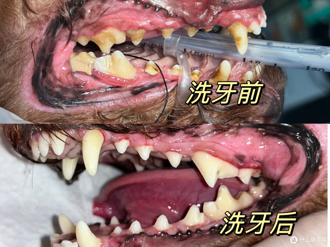 洗牙前后对比