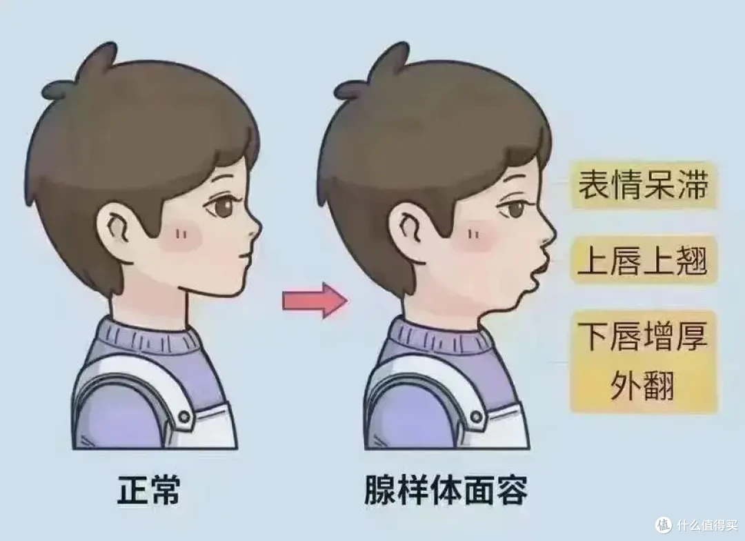人到中年，床头除了阿司匹林，还需要一台呼吸机保命！