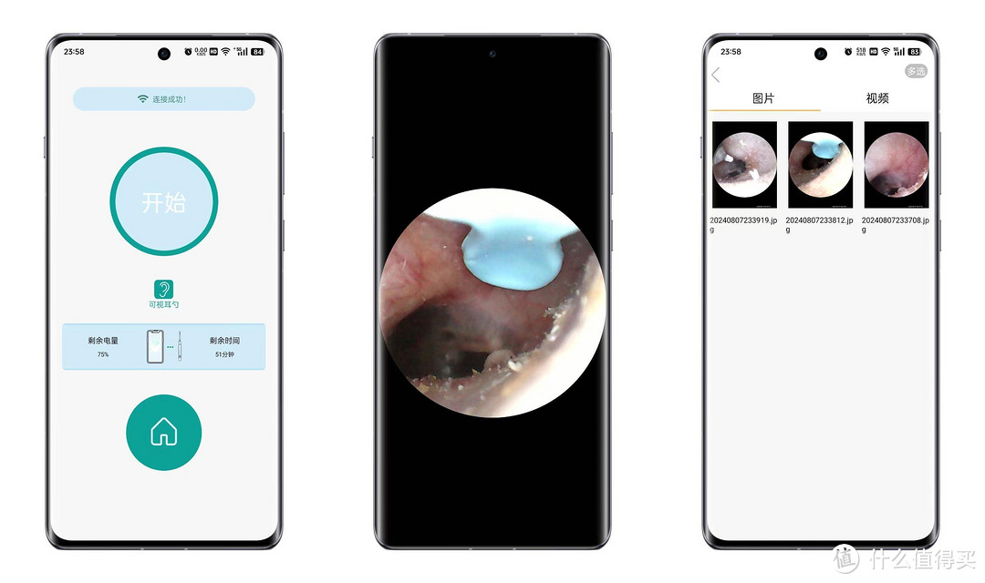 掏耳朵从未变得如此简单，西圣Find智能可视掏耳勺真好用