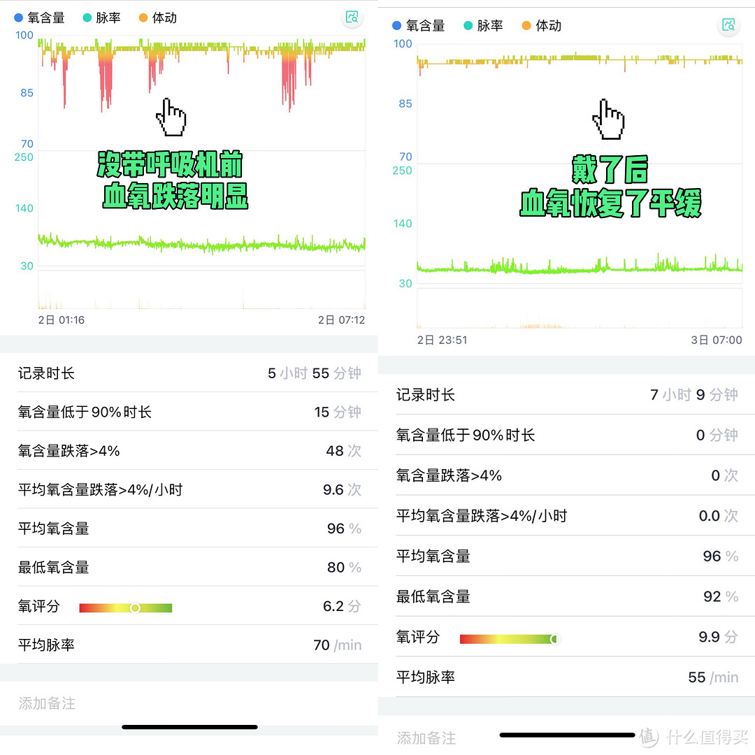 创新科技，专为优质睡眠设计，让您从此告别打鼾烦恼——乐普R20呼吸机