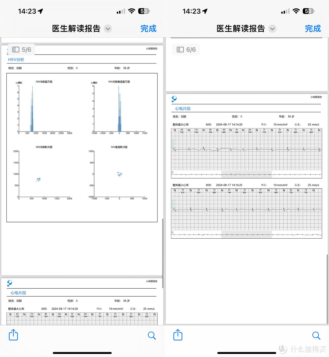 乐普心安宝 ER2-S 屏显版评测：集便携与医用级心电监护于一体，全面提升家庭心脏健康管理水平