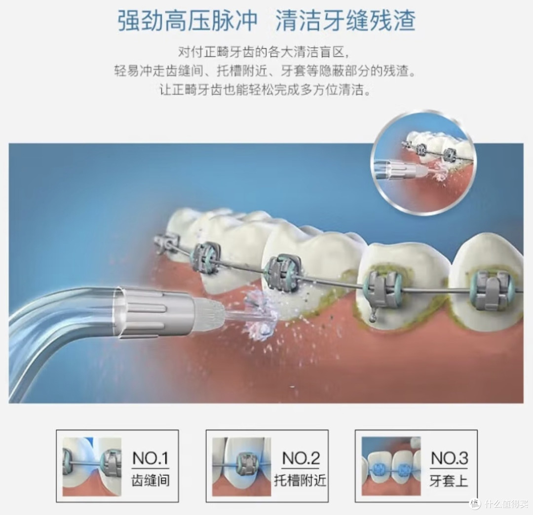 全国爱牙日，洗牙护牙全攻略！避坑指南+爆款产品助你拥有健康牙齿