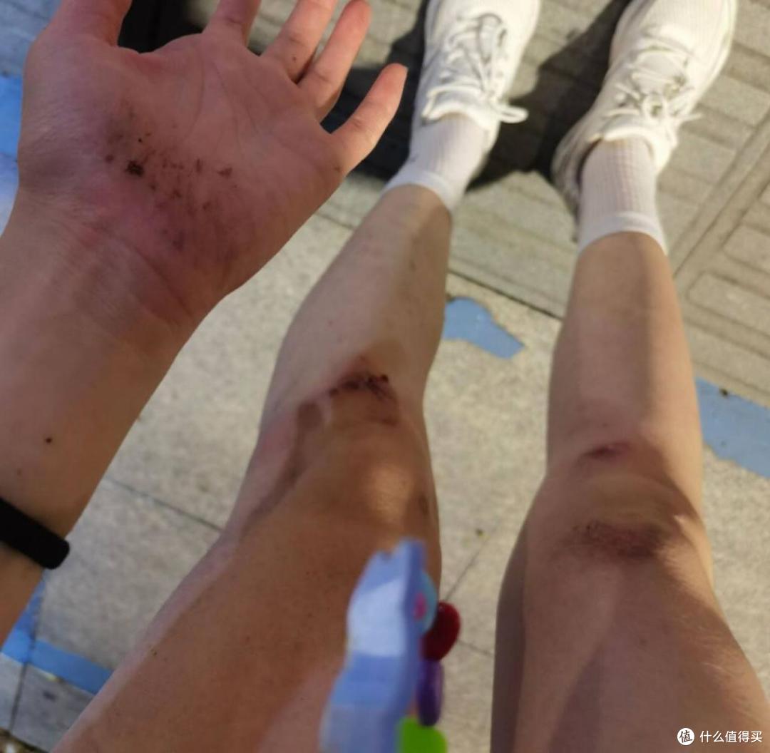 擦伤膝盖胳膊腿怎么护理才能不留疤摔伤后护理全过程实录跟我这样做真