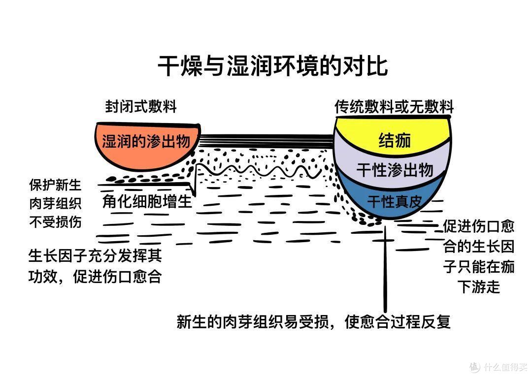 擦伤膝盖胳膊腿，怎么护理才能不留疤？摔伤后护理全过程实录，跟我这样做真的不留疤！！