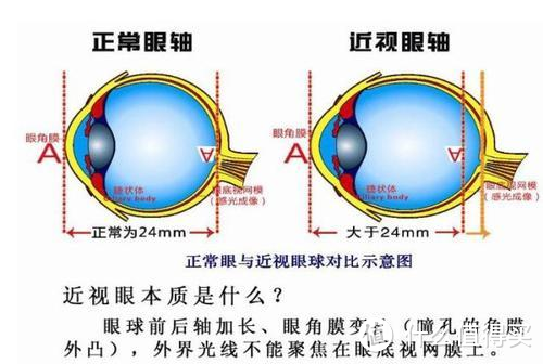 10 月 13 日是「世界视力日」，视力损伤流行率随年龄增长上升，怎样提前预防眼部疾病？有效护眼攻略