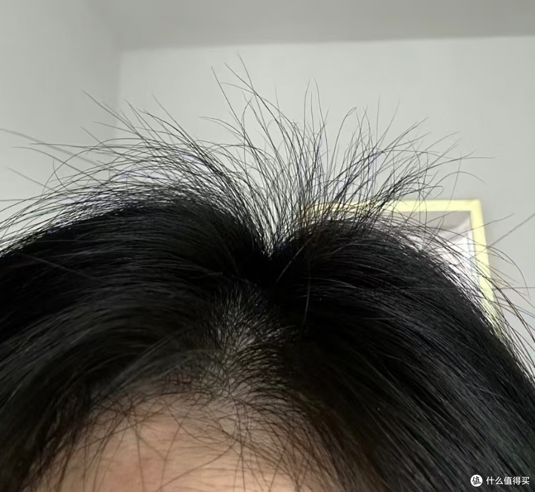 复合生发肽:科技引领下的生发新革命