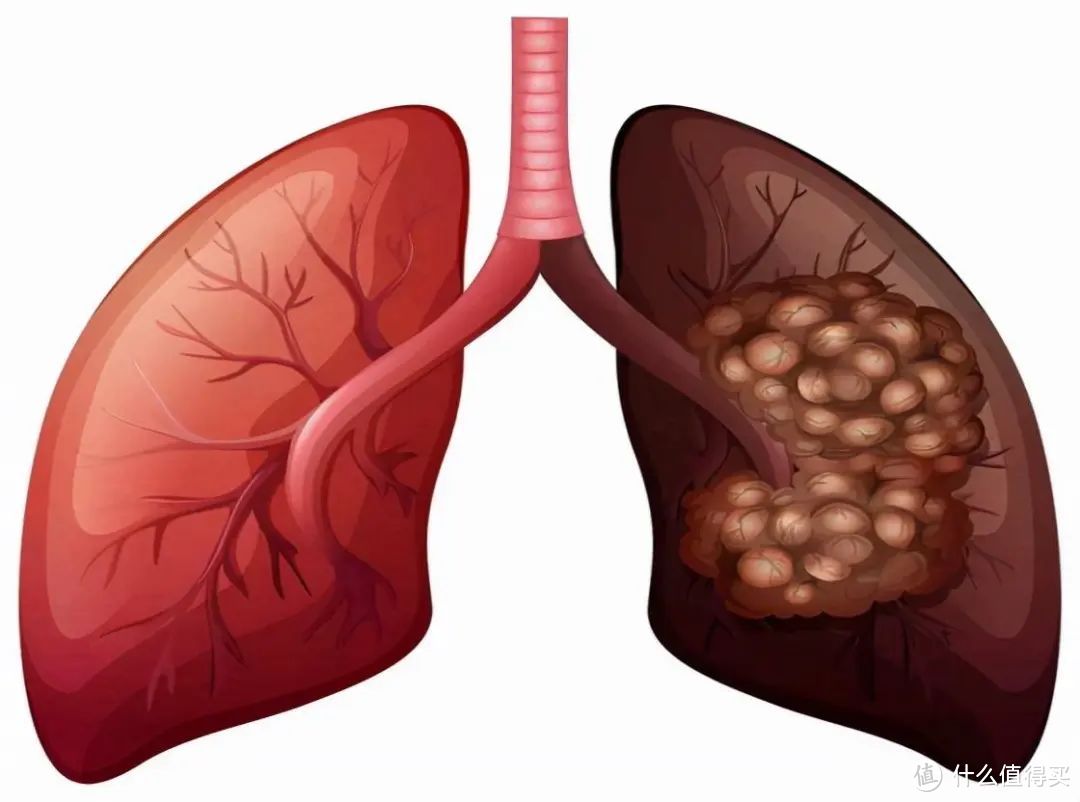 癌症为什么会致人死亡？
