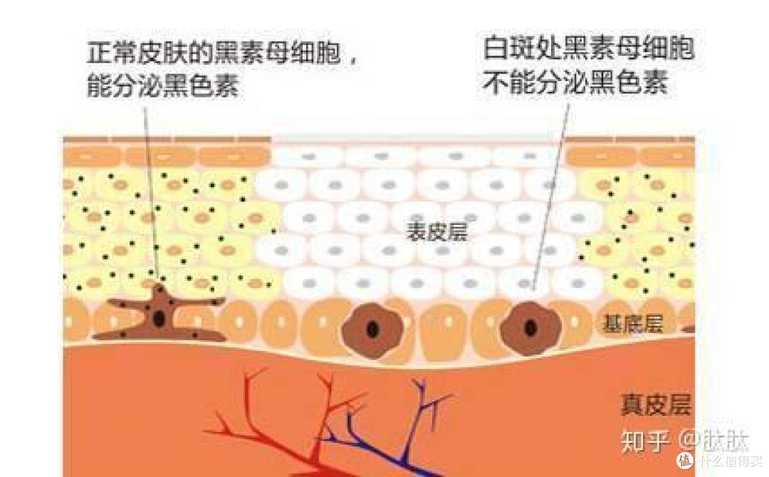 Dipeptide-1二肽-1|降低黑色素促进转录因子