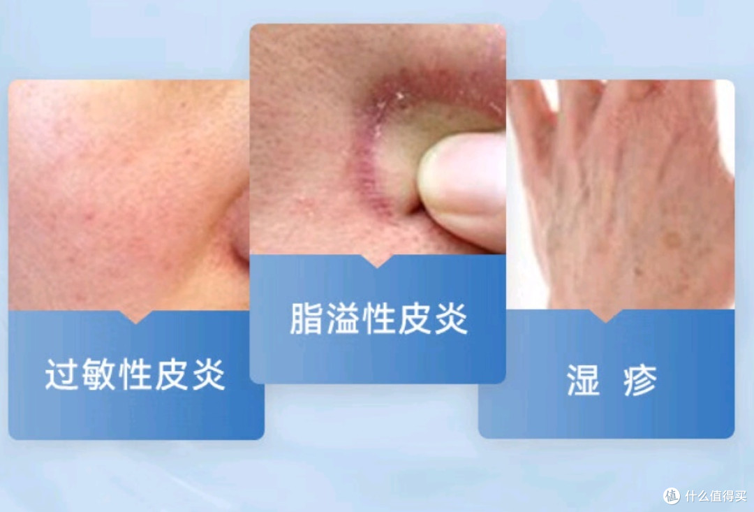 丁轻丁酸氢化可的松乳膏:秋季过敏的必备良品