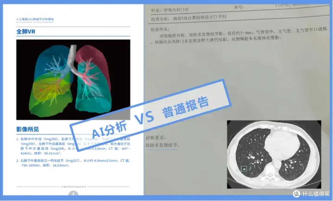 超级玛丽12号,重疾险测评,有什么优缺点?